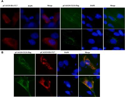 Duck enteritis virus UL7 is a late gene and the UL7-encoded protein co-localizes with pUL51